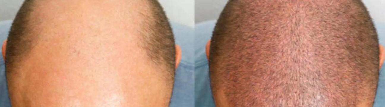 Myhair Line